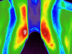 Digital Thermal Imaging - Digatherm